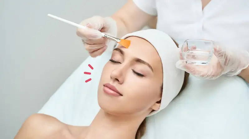 Peeling Kimia