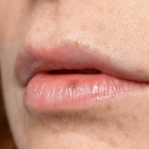 rekomendasi lip balm