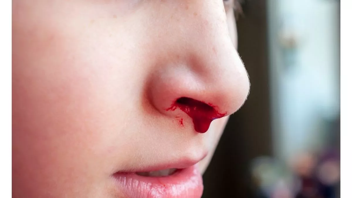 obat mimisan di apotik