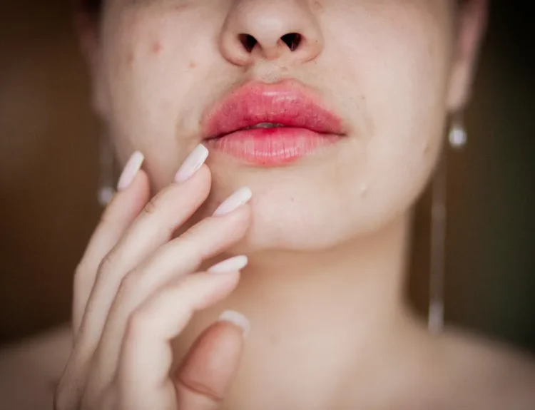 kedutan bibir kanan bawah