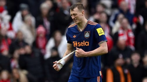 Dan Burn Jalani Pemulihan Cedera Bersama Newcastle